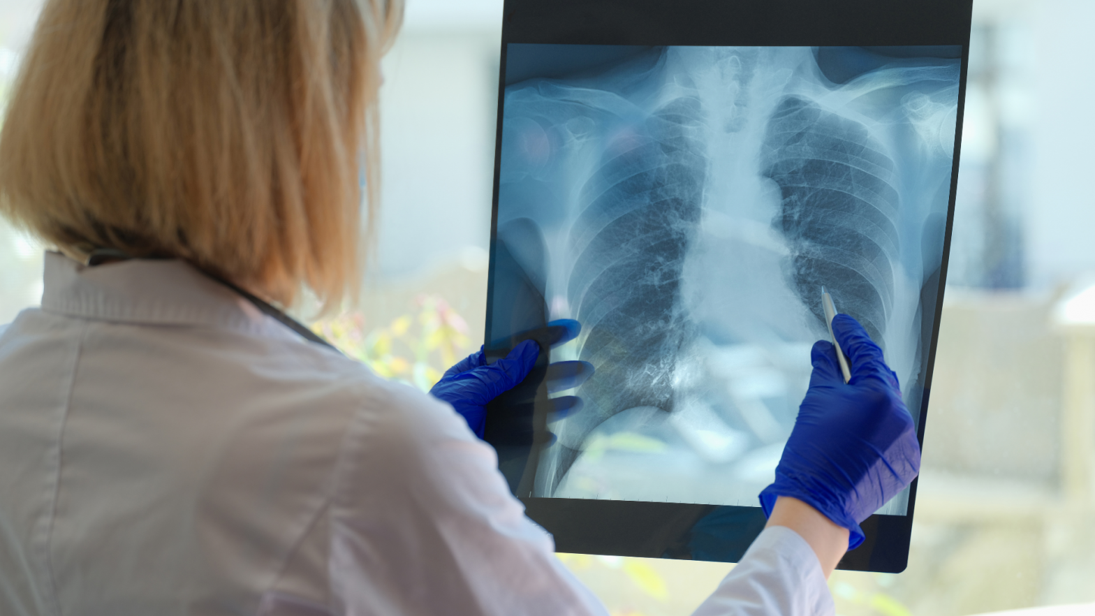 Desvelando Secretos Respiratorios: La Importancia de la Radiología en el Diagnóstico